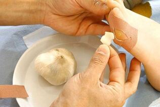 Trattamento del papilloma con impacco all'aglio